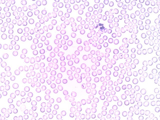 Leukocytes