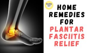 Read more about the article 10 Home Remedies for Plantar Fasciitis | Plantar Fasciitis Relief