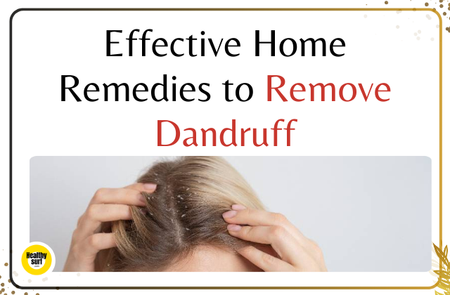 Effective Home Remedies to Remove Dandruff